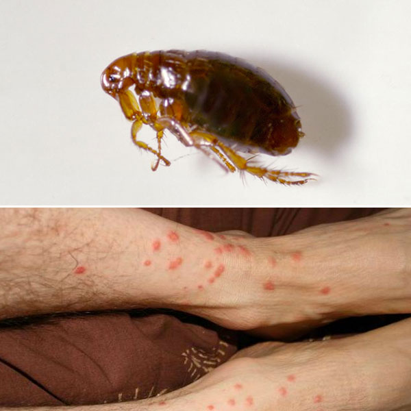 Piqûres d'insectes : comment reconnaître quel insecte vous a piqué ?