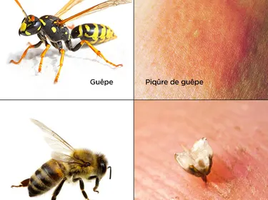 Les piqûres de guêpe et d’abeille